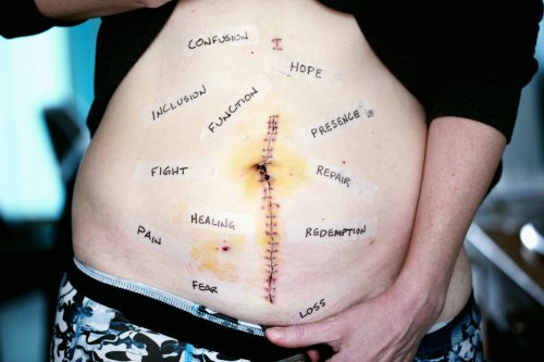 ptsd symptoms