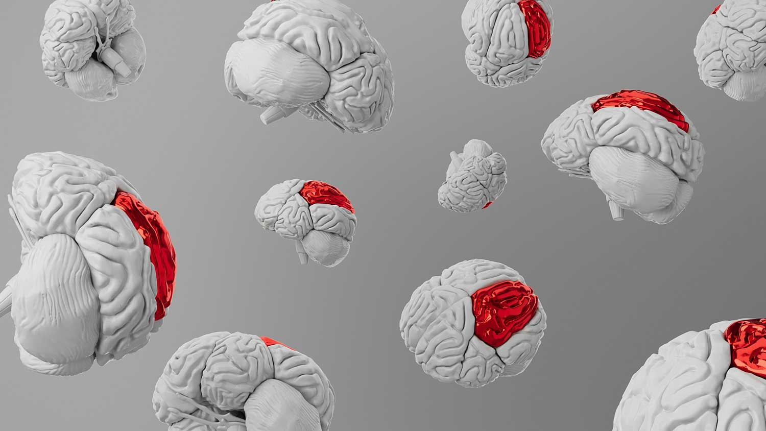 How to Protect Mental Well-Being Before Surgery